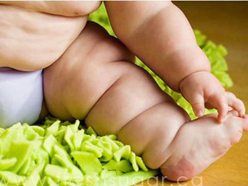 perna de um bebê com problemas de obesidade